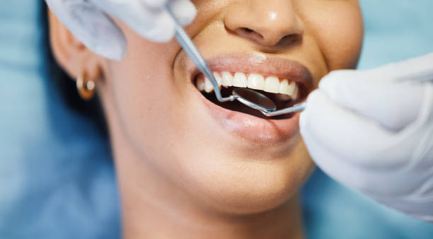 Best Emergency Dentist for Knocked-Out Tooth in Nellysford, VA