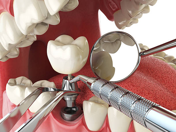 Best Emergency Dentist for Special Needs Patients in Nellysford, VA